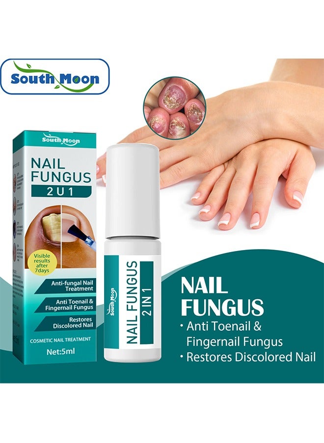 SOUTH MOON Toenail Fungus Treatment Extra Strength-Fungal Nail Treatment for Toe Nail and Fingernails-Nail Repair Solution for Thick/Broken/Discolored Nails-Renews Damaged Cracked Ingrown Toenail - Image 1