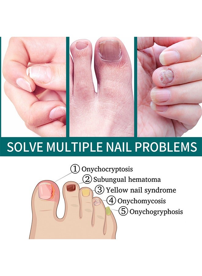 SOUTH MOON Toenail Fungus Treatment Extra Strength-Fungal Nail Treatment for Toe Nail and Fingernails-Nail Repair Solution for Thick/Broken/Discolored Nails-Renews Damaged Cracked Ingrown Toenail - Image 3