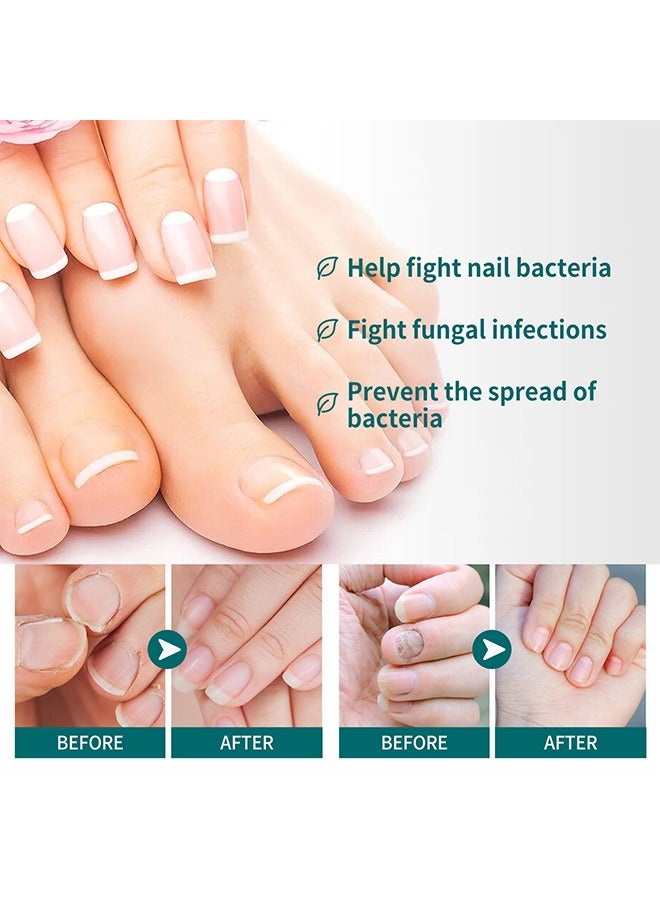 SOUTH MOON Toenail Fungus Treatment Extra Strength-Fungal Nail Treatment for Toe Nail and Fingernails-Nail Repair Solution for Thick/Broken/Discolored Nails-Renews Damaged Cracked Ingrown Toenail - Image 4