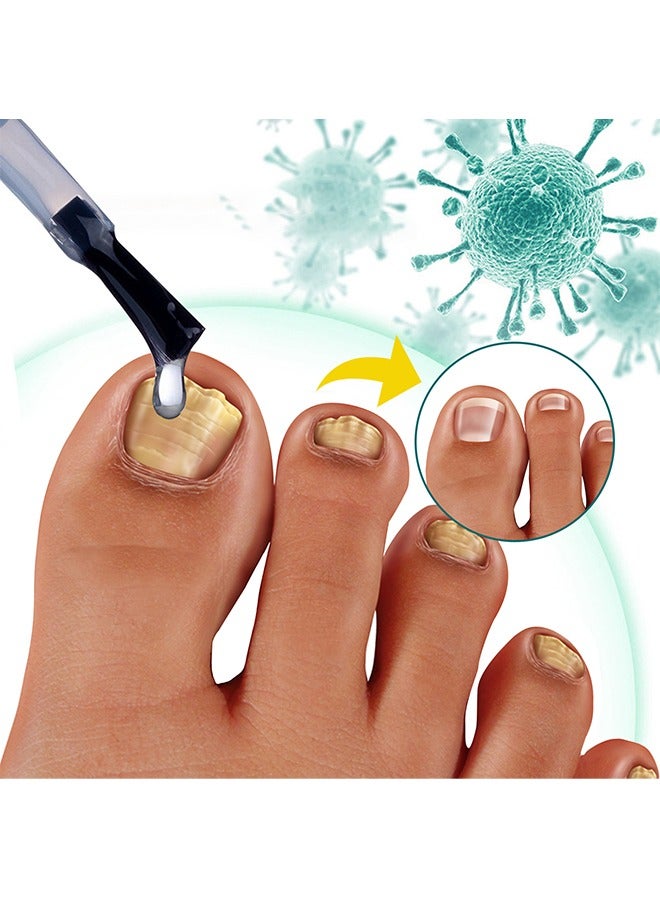 SOUTH MOON Toenail Fungus Treatment Extra Strength-Fungal Nail Treatment for Toe Nail and Fingernails-Nail Repair Solution for Thick/Broken/Discolored Nails-Renews Damaged Cracked Ingrown Toenail - Image 5