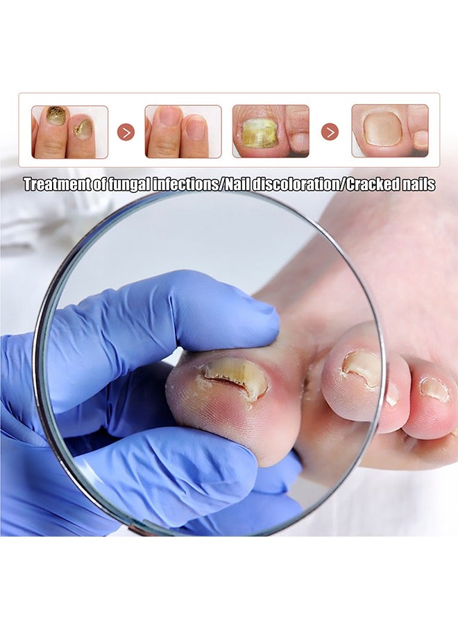 SOUTH MOON Toenail Fungus Treatment Extra Strength-Fungal Nail Treatment for Toe Nail and Fingernails-Nail Repair Solution for Thick/Broken/Discolored Nails-Renews Damaged Cracked Ingrown Toenail - Image 2