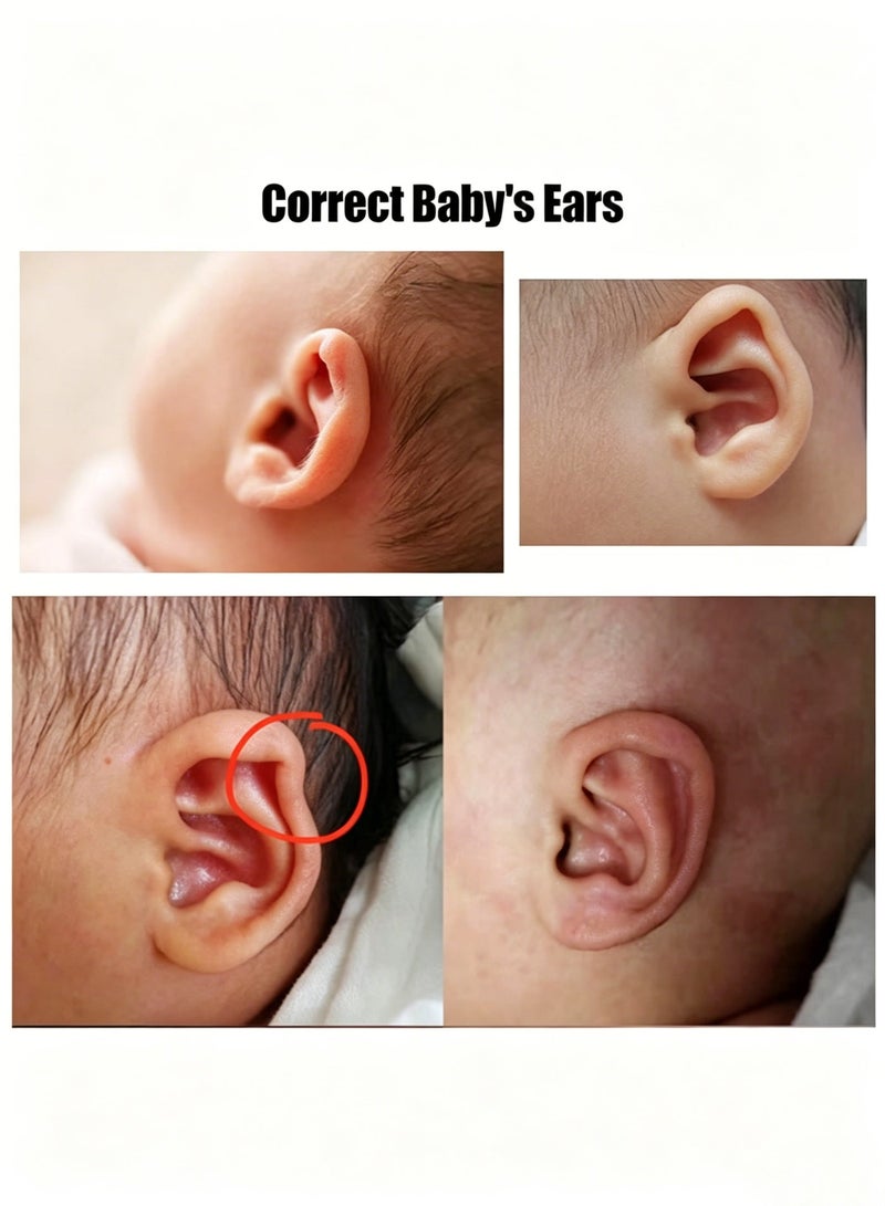 Amanli 2 Pes Auricle Valgus Correction Patch for Baby, Children Ear Correction, Newborn Baby Ear Aesthetic Correctors, Infant Protruding Ear Stickers (4cm*100cm) - Image 5