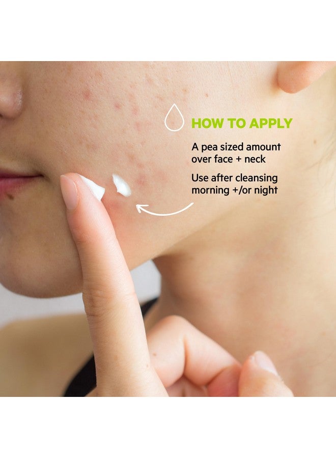 اس في أر كريم ترطيب الوجه SVR Sebiaclear - مرطب مهدئ، يقلل من ظهور العلامات، مع النياسيناميد وحمض الهيالورونيك والسيراميد للبشرة الدهنية الحساسة، غير كوميدوغينيك. 1.4 أونصة. - Image 4