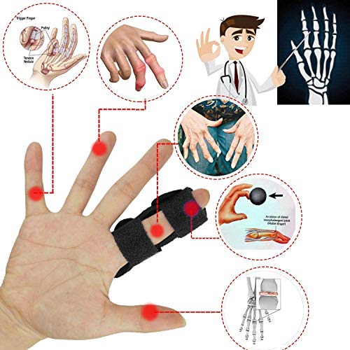 Cetaplast Nylon Splints Finger Straightener, Support Stabilizer Brace For Broken, Strained, Sprained, Swollen,Arthritis Or Tendinitis (Black) - Image 5