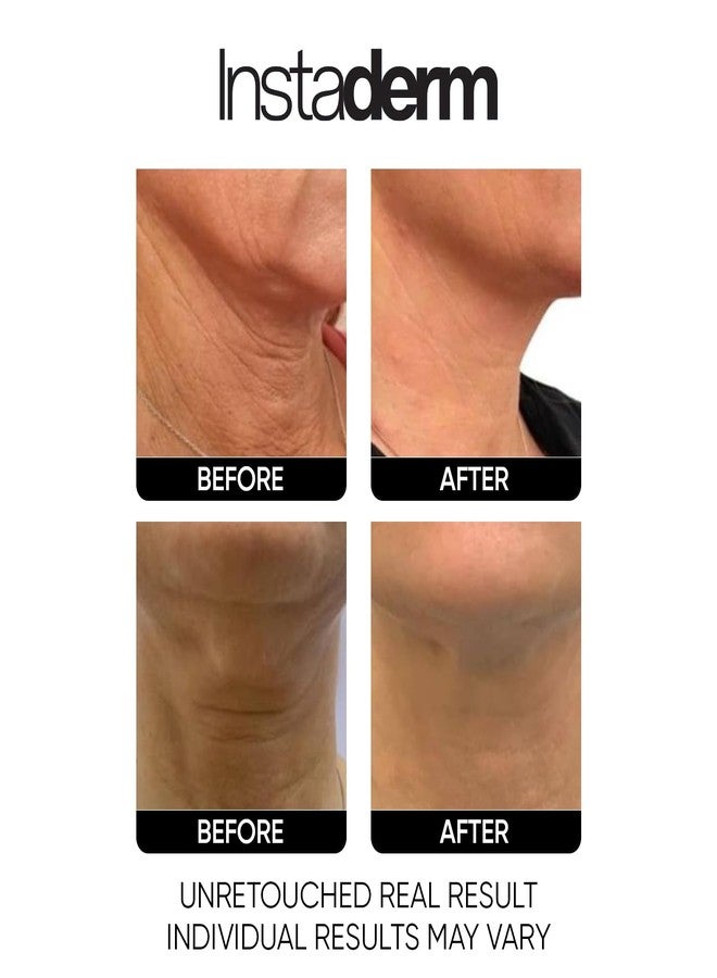 Instaderm Neck and Décolleté Firming Cream - Tightening & Lifting Treatment for Crepey, Wrinkles, sagging Skin & Vertical Lines. Anti-Aging Peptide Formula to Boost Hydration & Collagen in the Skin. - Image 5