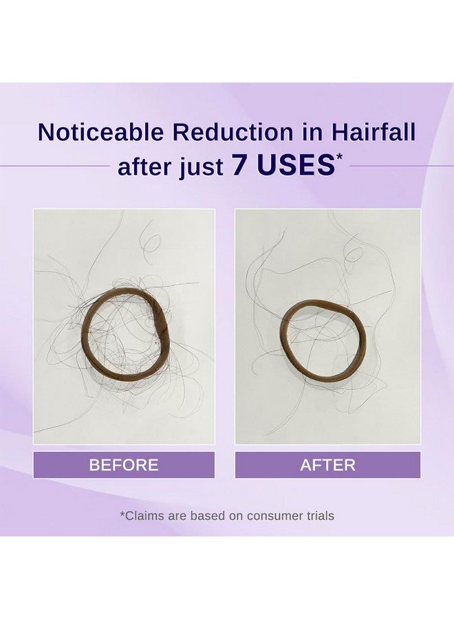 بار_اناتومي زيت نمو الشعر من Nature X Science بالروزماري والكركديه للنساء والرجال | يعزز نمو الشعر الجديد ويقوي الشعر | يغذي فروة الرأس ويتحكم في تساقط الشعر | مناسب لجميع أنواع الشعر - 100 مل - Image 3