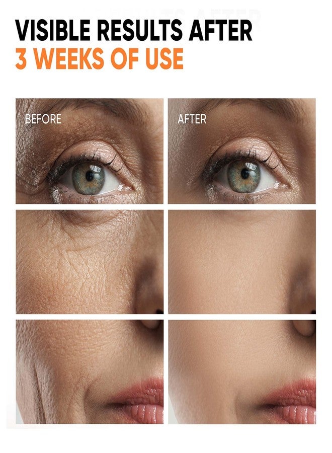 Everyouth Vitamin C Serum for Face 20% Hyaluronic Acid, Niacinamide, Vitamin E, Collagen Peptides - Skin Brightening Solution for Wrinkles, Dark Spots, Fine Lines - Anti Aging Stem Cell Serum for Face, 1 oz - Image 5