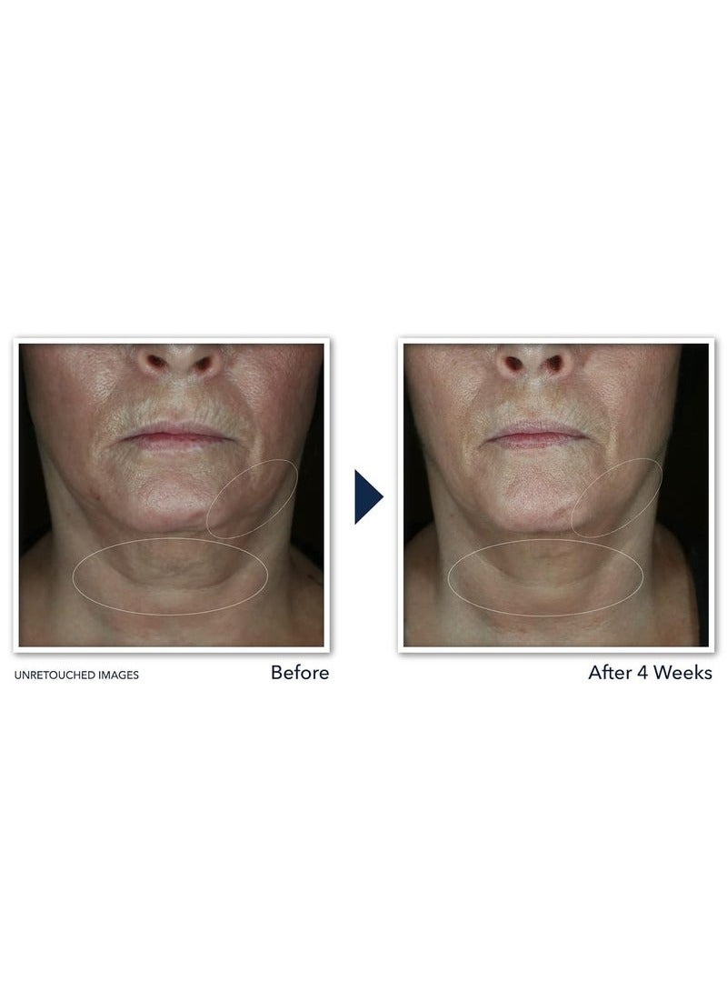 RoC Derm Correxion Neck Cream with Hyaluronic Acid and Advanced Retinol to visibly Tighten & Lift Horizontal Neck Lines, Facial Moisturiser to Contour Face, Neck + Jaw, (1.7 oz) - Image 3