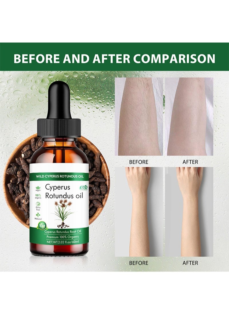 LUNOON Cyperus Rotundus Oil-Cyprus Oil Natural Nut Grass Mix Oil for Reducing Body Hair Growth,Smooth Skin and Hair Removal,Moisturizing and Soothing,Ideal for All Skin Types  - Image 5