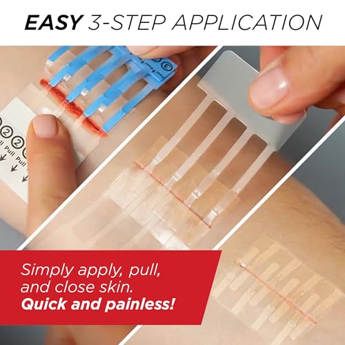 Clozex Emergency Laceration Closure Only- Close Wounds Without Stitches with This Surgical-Grade Skin Device. Available in 3 Variations for Wounds up to 1.0” or 3.5”. Life Happens, Be Ready! - Image 5