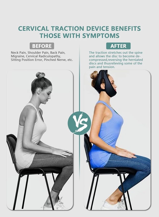 Yonghui factory cervical traction device household stretching medical suspension vertebra neck treatment device neck pain correction frame - Image 5