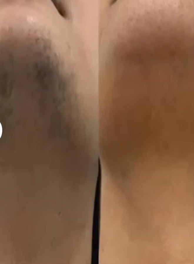 زيت السعد المستدير لإزالة الشعر - زيت مرطب طبيعي لطيف ومهدئ للبشرة، يقلل من نمو الشعر تحت الجلد ويصغر المسام، تركيبة مرطبة (1، 60 مل) - Image 4