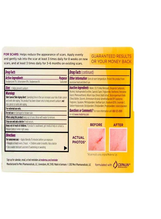 Mederma Cream 20 g ( Pack of 4 - Image 3