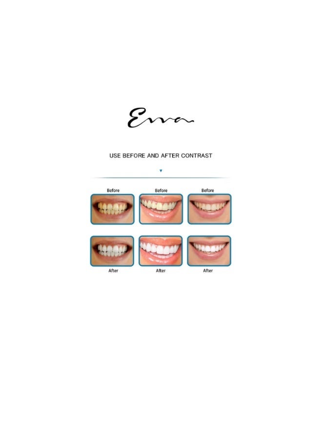 Evva Cordless Water Flosser for Teeth – Portable Rechargeable Oral Irrigator with 4 Jet Tips, 3 Pressure Modes, Waterproof Design for Travel & Home Dental Care - Image 2