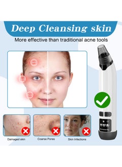 BTFMEI Blackhead Remover Vacuum, Electric Acne Comedone Whitehead Remover Tools, Face Cleaner and Blackhead Extractor with 3 Adjustable Suction Levels, 4 Probes - Pore Vacuum Kit  - Image 5