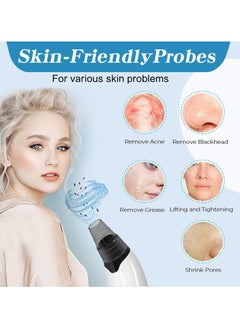 BTFMEI Blackhead Remover Vacuum, Electric Acne Comedone Whitehead Remover Tools, Face Cleaner and Blackhead Extractor with 3 Adjustable Suction Levels, 4 Probes - Pore Vacuum Kit  - Image 3