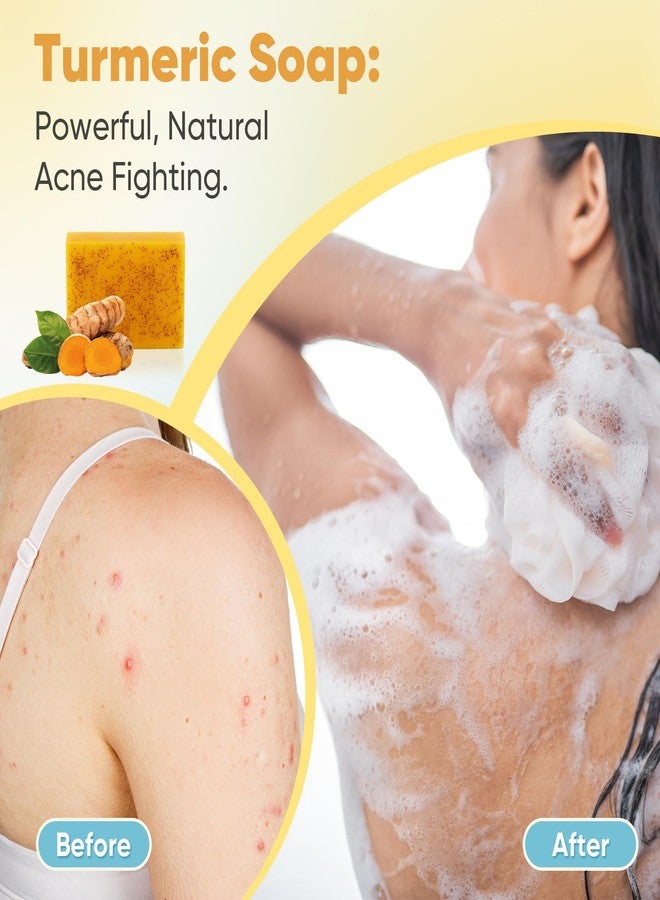 Treeroot 5 Pack Turmeric Soap, 80g Kojic Acid and Turmeric Soap Bar, Gently Clean the Face, Contains Retinol, Collagen, Vitamin C, Shea Butter, Used for Face & Body, SLS Free - Image 5