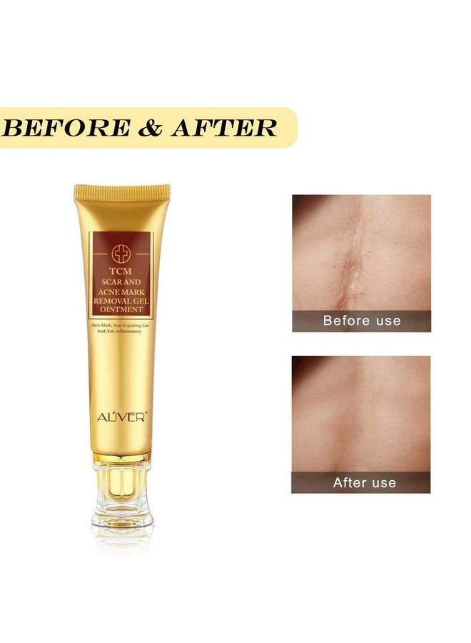 ALIVER 3 Pack Scar Removal Creamtcm Scar Cream For Surgical Scars Acne Skin Care Cream Acne Treatment Cream For Scars Burns Stretch Marks Acne Spots  - Image 4