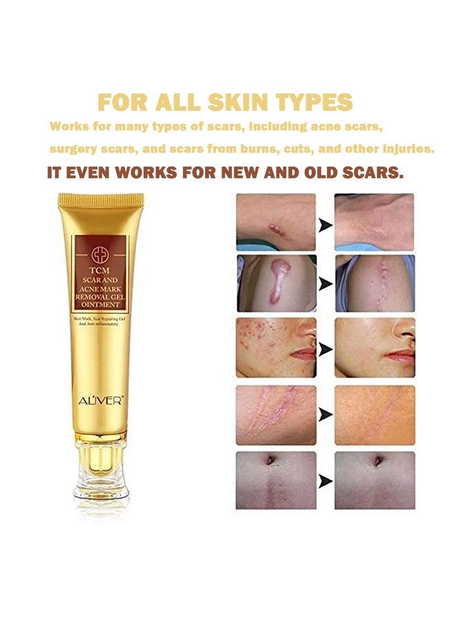 ALIVER 3 Pack Scar Removal Creamtcm Scar Cream For Surgical Scars Acne Skin Care Cream Acne Treatment Cream For Scars Burns Stretch Marks Acne Spots  - Image 2