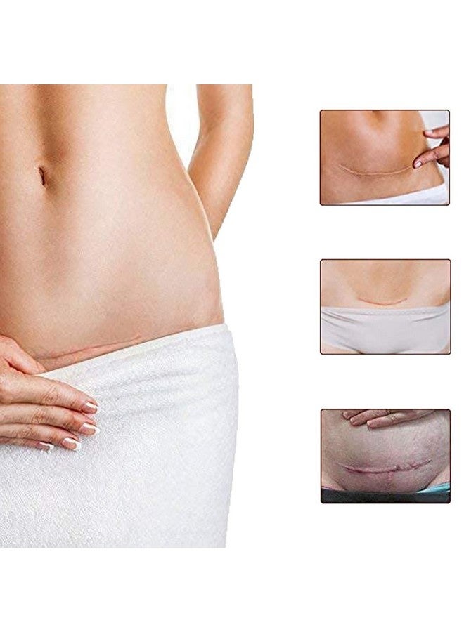 ALIVER 3 Pack Scar Removal Creamtcm Scar Cream For Surgical Scars Acne Skin Care Cream Acne Treatment Cream For Scars Burns Stretch Marks Acne Spots  - Image 5
