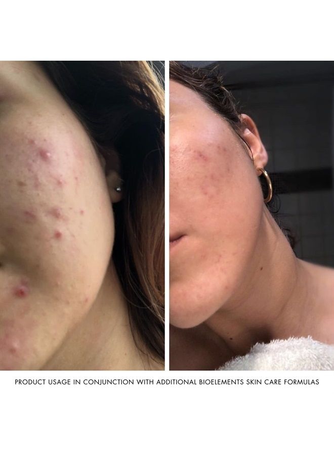 Bioelements محرر البشرة - 1.7 أونصة سائلة - كريم تقشير كيميائي AHA للبشرة لجميع الأنواع - مع 3% حمض الجليكوليك و7% حمض اللاكتيك - نباتي، خالي من الغلوتين - لم يتم اختباره على الحيوانات - Image 4