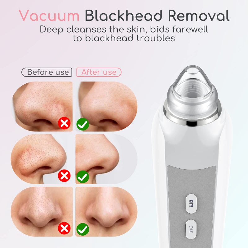 TTozka Blackhead Remover Vacuum, Black Head Remover for Face with Camera, Pore Vacuum for Men and Women, USB Interface Type Blackhead Remover Tools, 6 Suction Heads & 3 Adjustment Modes (Grey) - Image 5