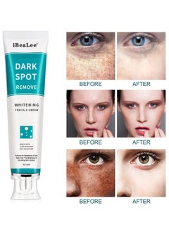 iBealee Dark Spot Remover Whitening Freckle Cream Fades Dark Spots And Evens Skin Tone Brightens Complexion Freckle Remover Brightening Deep Moisturizing Dark Spot Corrector 20g  - Image 1