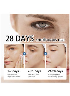 iBealee Dark Spot Remover Whitening Freckle Cream Fades Dark Spots And Evens Skin Tone Brightens Complexion Freckle Remover Brightening Deep Moisturizing Dark Spot Corrector 20g  - Image 5