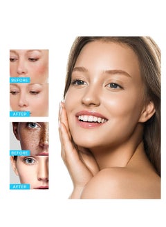 iBealee Dark Spot Remover Whitening Freckle Cream Fades Dark Spots And Evens Skin Tone Brightens Complexion Freckle Remover Brightening Deep Moisturizing Dark Spot Corrector 20g  - Image 4