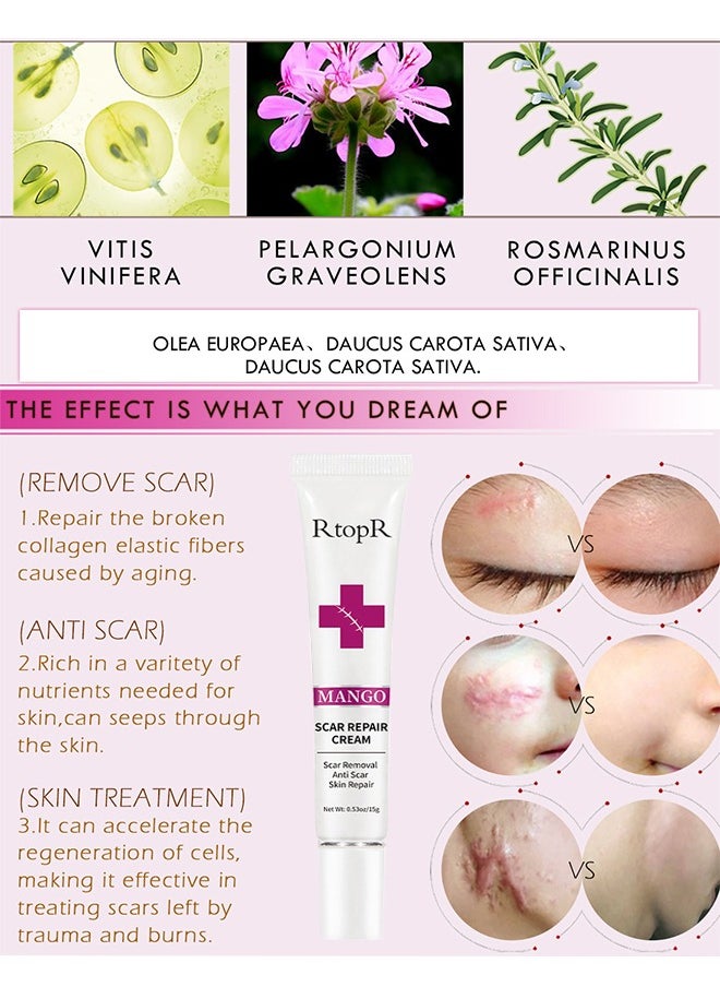 RtopR - Scar Repair Cream-Skin Repair Creams Treatment Stretch Marks Acne Surgical Care 15g - Image 1