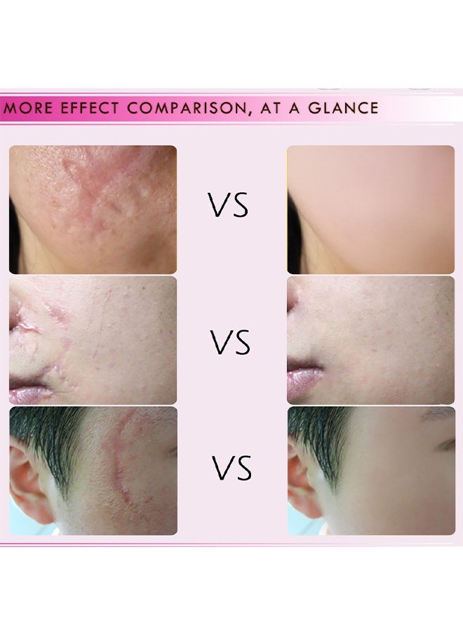 RtopR - Scar Repair Cream-Skin Repair Creams Treatment Stretch Marks Acne Surgical Care 15g - Image 1