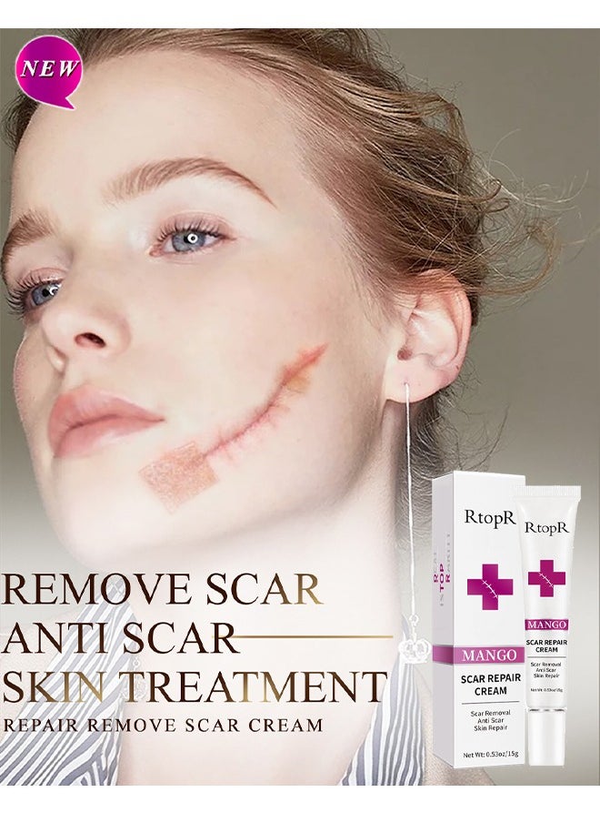RtopR - Scar Repair Cream-Skin Repair Creams Treatment Stretch Marks Acne Surgical Care 15g - Image 1