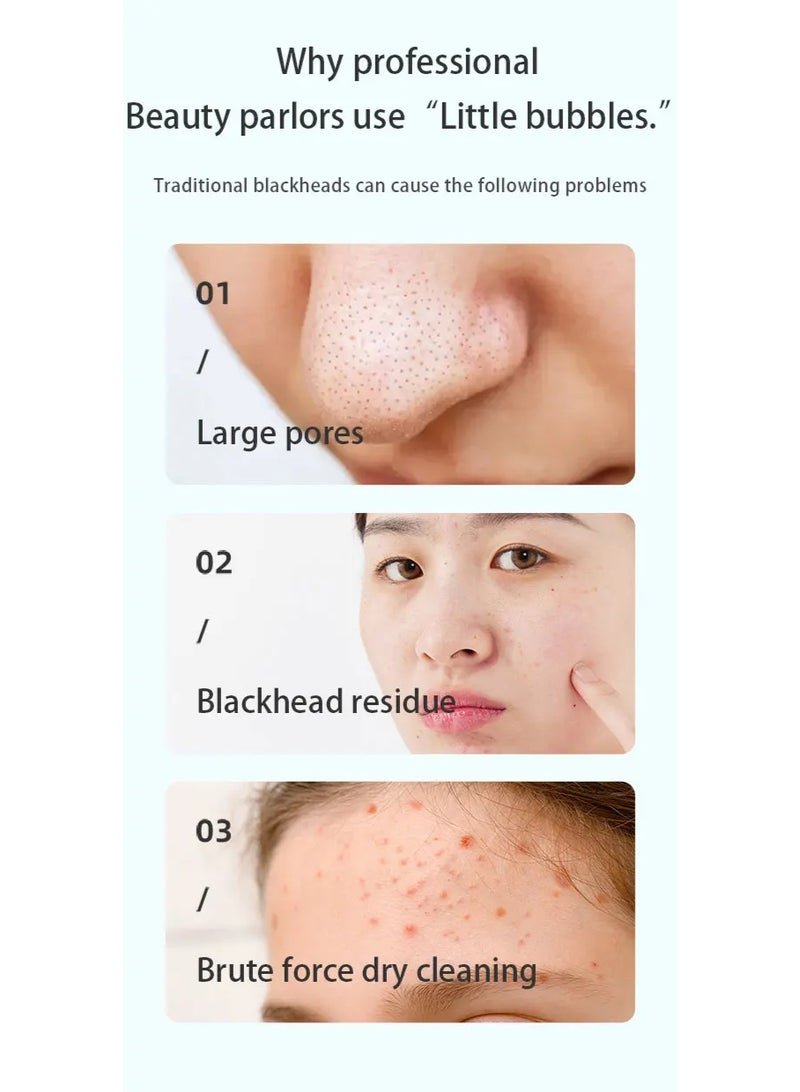 Hot Compress Small Bubble Blackhead Remover Pore Cleaner Acne Remover Beauty Instrument - Image 3