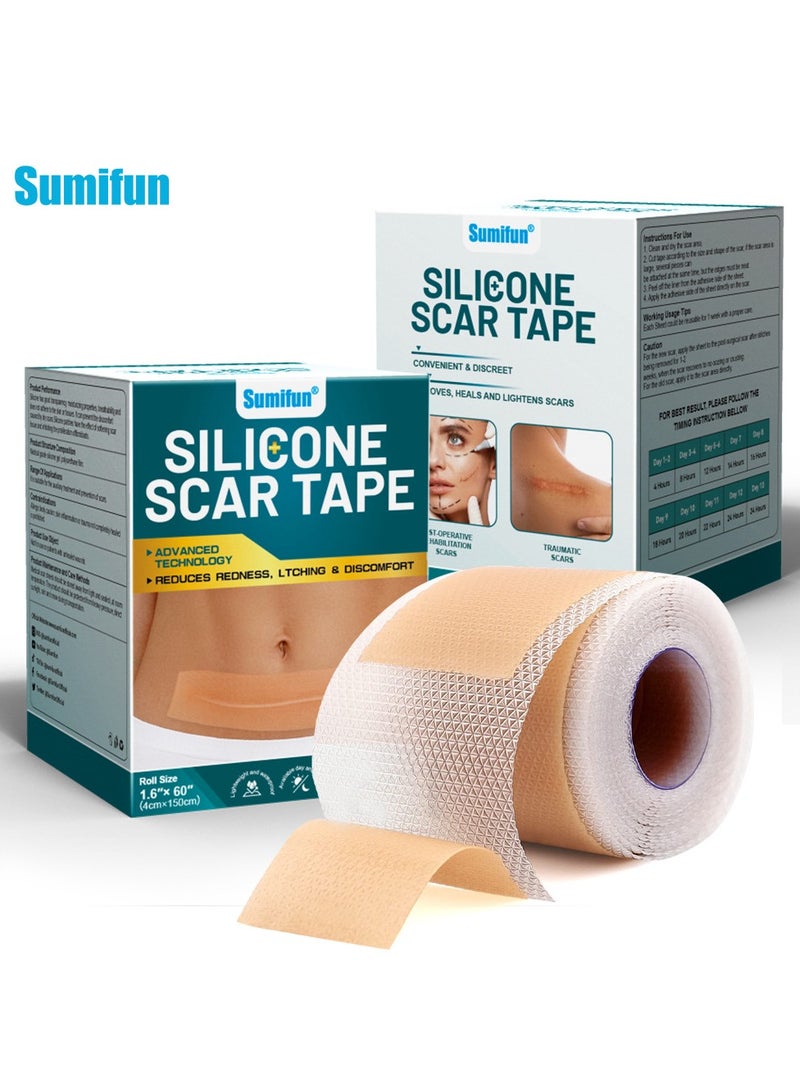 سوميفون رقعة إصلاح الجروح، رقعة إزالة الندبات الجراحية، رقعة العناية بندبات الصدمات الرياضية (4*150 سم) - Image 1