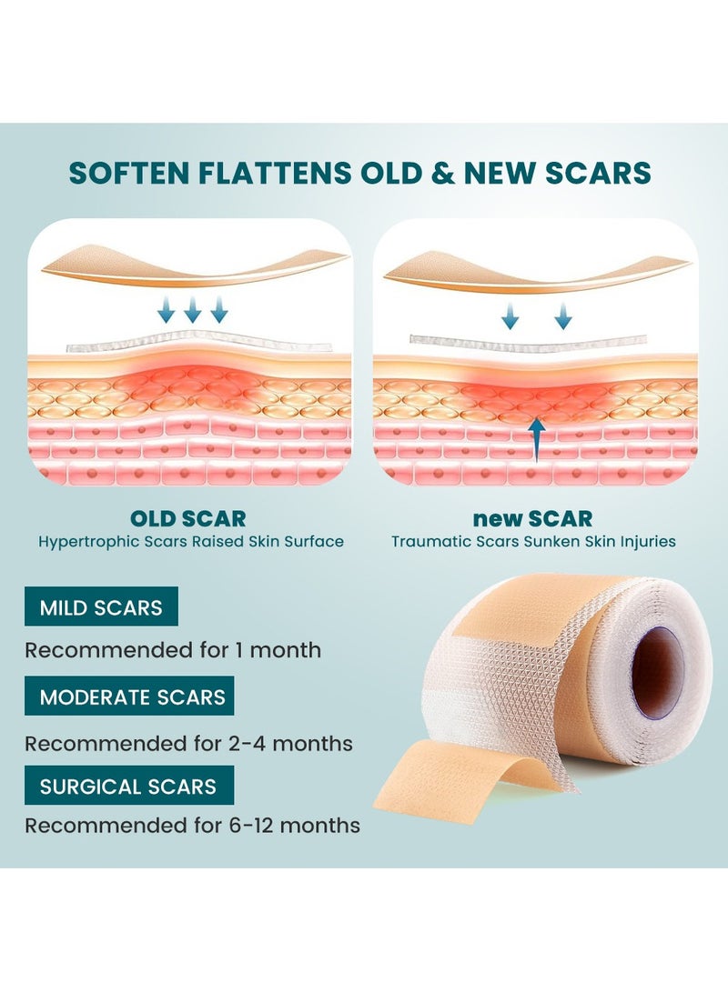 سوميفون رقعة إصلاح الجروح، رقعة إزالة الندبات الجراحية، رقعة العناية بندبات الصدمات الرياضية (4*150 سم) - Image 2