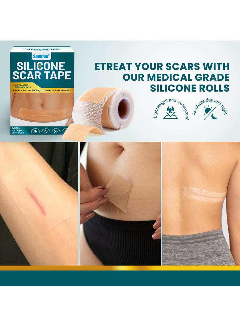 سوميفون رقعة إصلاح الجروح، رقعة إزالة الندبات الجراحية، رقعة العناية بندبات الصدمات الرياضية (4*150 سم) - Image 3