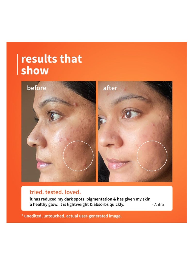 Plum 10% Vitamin C & Calendula Barrier Boosting + Glow Serum | Boosts glow from 1st use | Ceramides strengthens skin barrier | Niacinamide fights pigmentation & dark spots | Non-irritant| Men & Women | For all skin types | 30ml - Image 2