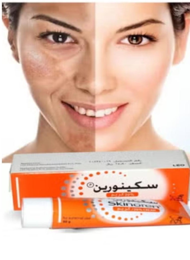 Skinoren Acne Treatment Cream 