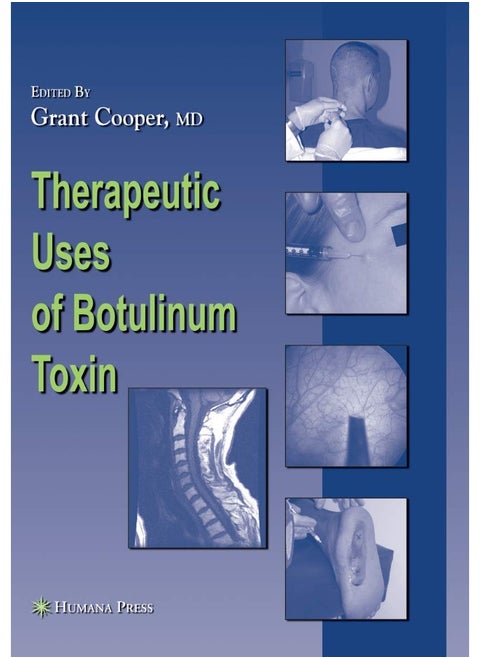 Therapeutic Uses of Botulinum Toxin