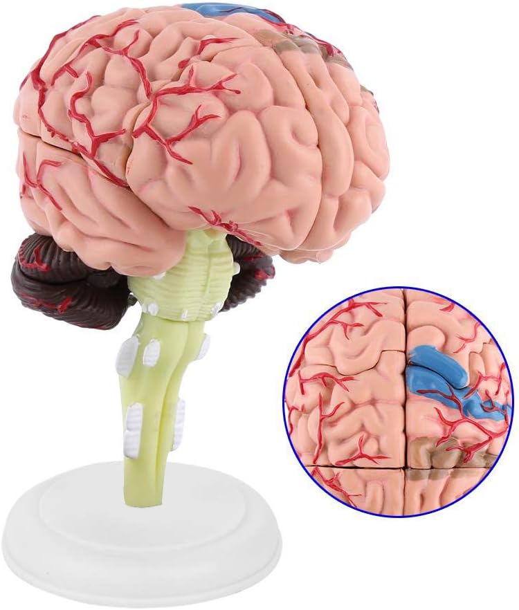 Elegant multi-option build Brain Model Disassembled Brain Model Human Anatomical Colorful 4D Structure Teaching Learning Tool for General Anatomical Study Stable inert material Home & light industrial compatible Gulf approved global quality Modern practical shape Upgraded quality Set product combo compatible Heat insulation layer Durable versatile substance Trendy natural tone options All space matching look Advanced minimal build Foldable Shop & home all-space compatible Multi-source stock guarantee Multi-purpose fine material UV resistant Stable local goods source Worldwide simple practical design Anti slip Global light sturdy raw material Trusted all-purpose quality Local trackable shipment Heat resistant Popular trusted craftsmanship - Image 3