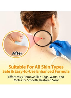 Sefudun 60ml Bee Venom Wart Remover Spray Skin Tag Removal Safe and Painless Clear Skin Tag and Mole Skin Tag Remover for All Skin Types Tag Recede Bee Venom Spray  - Image 3