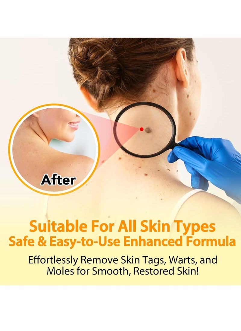 Sefudun 60ml Bee Venom Wart Remover Spray Skin Tag Removal Safe and Painless Clear Skin Tag and Mole Skin Tag Remover for All Skin Types Tag Recede Bee Venom Spray  - Image 3