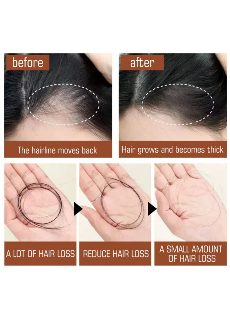 EELHOE - Batana Oil: Organic Formula for Hair Growth, Thicker, Fuller, and Healthier Locks - A Natural Hair Mask. (1PCS) - Image 1