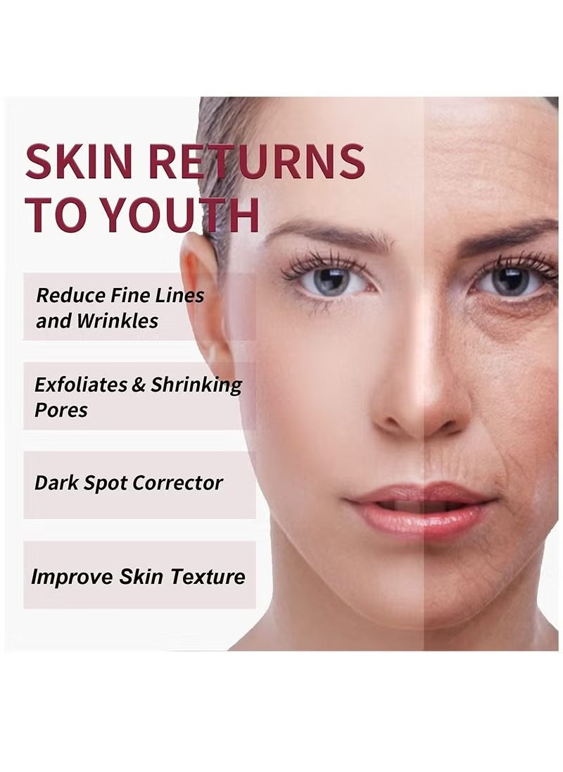 MOOYAM - AHA 30% + BHA 2% Peeling Solution Exfoliating AHA 30% BHA 2% Peeling Solution Anti Acne Serum Chemical Peel for Face at Home BHA AHA Mask Red Peel BHA Liquid Exfoliant for Blemishes Wrinkle 30ml - Image 1