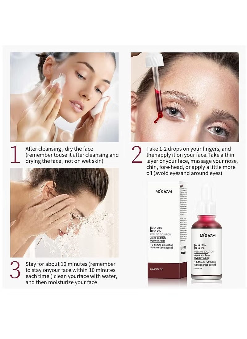 MOOYAM - AHA 30% + BHA 2% Peeling Solution Exfoliating AHA 30% BHA 2% Peeling Solution Anti Acne Serum Chemical Peel for Face at Home BHA AHA Mask Red Peel BHA Liquid Exfoliant for Blemishes Wrinkle 30ml - Image 1