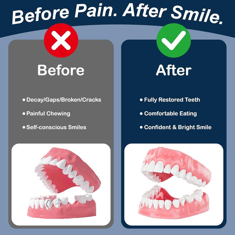 WeekCare Dental Lab Denture Repair Glue (1oz) - Fast-Setting, Instant Bonding Adhesive for Broken Dentures and Teeth Repair - Strong Bond for Securely Fixing Cracks Instantly Lasting Days to Weeks - Image 4
