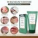 Moraz Skin Saver Herbal Healing Scar Gel for Skin Repair and Wound Care MultiPurpose First Aid Moisturizer for Dry Skin Minor Cuts and Scrapes Bug Bite Itch Relief Sunburn Rashes 17 Oz - Image 4