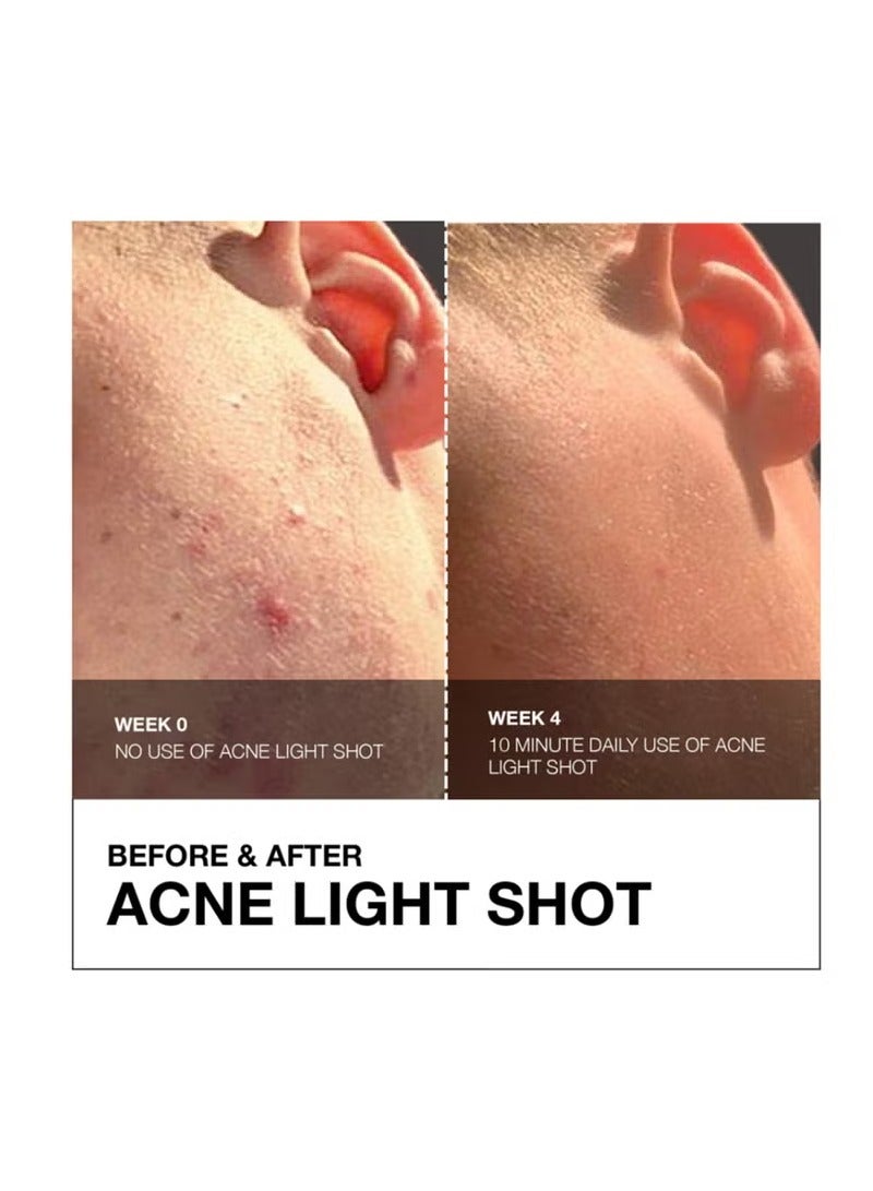 جهاز FaceGym لعلاج حب الشباب بالضوء - Image 4