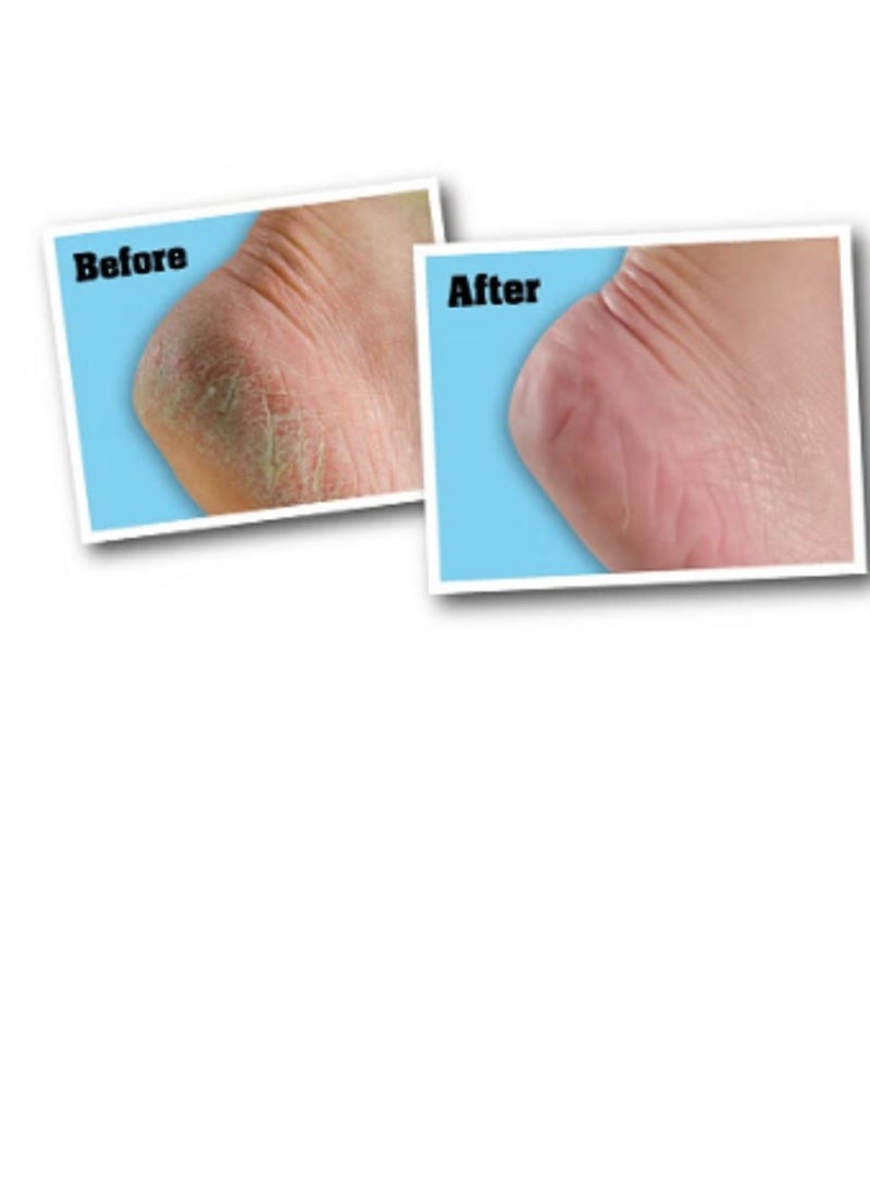 O'Keeffe's Healthy Feet Cream 91grams  - Image 2