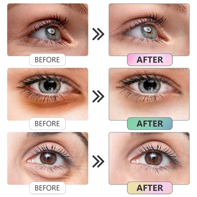 Sheet Face Masks Skincare for All Skin Types UNDER Eye Patches -1 Pairs Caviar Essence Eye Mask for Puffy, Reducing Dark Circles, Anti-Aging, Moisturizing-CAVEAR - Image 2